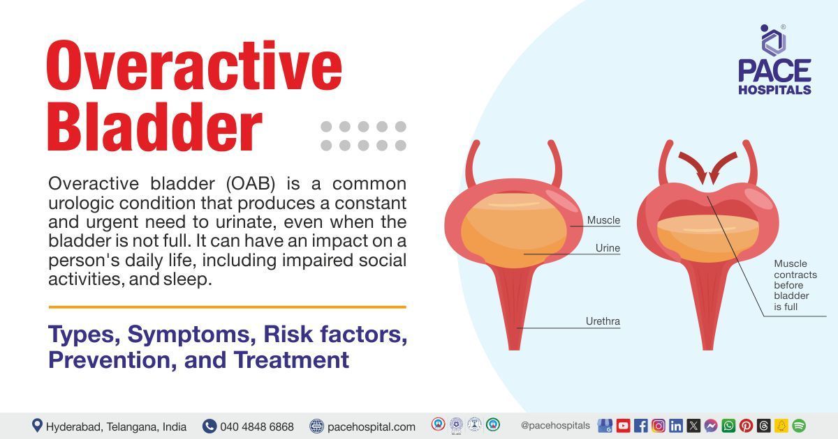 3 effective tips to control overactive bladder